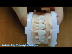 มงกุฎซิกอร์คอนีพร้อมเครื่องประดับ