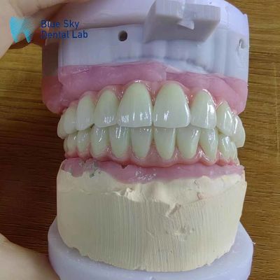 ซื้อ ความเหมาะสมทั่วไป สะพานโลหะ Malo ด้วยกรอบไทเทเนียมบริสุทธิ์ online manufacture