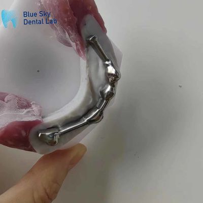 ซื้อ สตาร์ทิตาเนียมฟันที่สามารถปรับแต่งได้ กับฟันที่ใช้เป็นขั้นตอนสําหรับขั้นตอนการปรับฟัน online manufacture