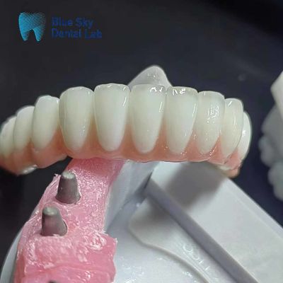 ซื้อ กล่องปลูกฟันซิกโคนยาธรรมดา online manufacture