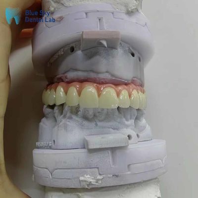 ซื้อ สาธารณธรรม การปลูกฟันเทียม กล่องปลูกฟันเต็มปาก online manufacture