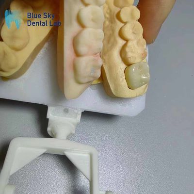 ซื้อ หนาทนทานต่อการกัดกรอง Zirconia Crown สี Zirconia ที่ดูเป็นธรรมชาติ online manufacture