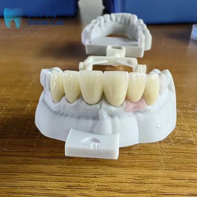 ซื้อ ราชมงคลซิกโคนยาชั้นละเอียดสูงธรรมชาติที่มีราชมงคลการปลูก online manufacture