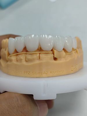ซื้อ 5 มม-6 มม ลาย Zirconia ราชมงคล ความแข็งแรง Zirconia ราชมงคลหลายชั้น online manufacture