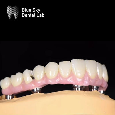 ซื้อ สีฟ้าธรรมชาติ โครงการปลูกฟัน online manufacture