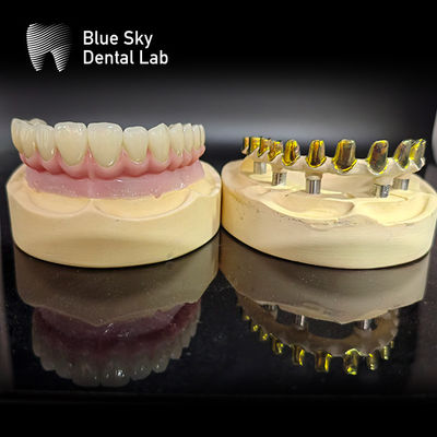 ซื้อ สกรูรักษา MUA หลักการฝังกล่อง Zirconia กษัตริย์ โปรเซลีนชมพูหลายชั้นที่มีการซ่อมแซมง่าย online manufacture