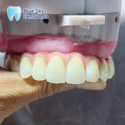 ซื้อ กรณีการฝังสําหรับระบบฝังหลายตัว online manufacture