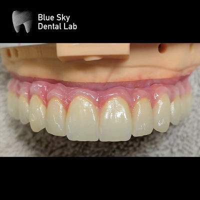 ซื้อ สากลหลายตัวเลือก กล่องการปลูกที่ออกแบบสําหรับพื้นผิวเรียบและการทําความสะอาดน้ําหอมที่ไร้สาระ online manufacture