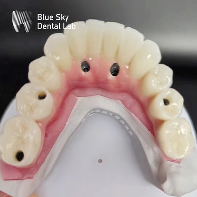ซื้อ กล่องการปลูกฟันแบบ Full Arch ที่เข้ากันได้กับระบบปลูกฟันหลายแบบ online manufacture