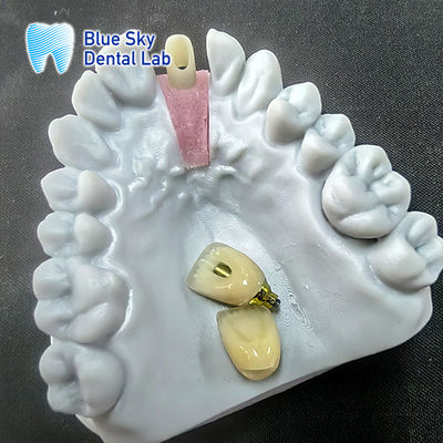 ซื้อ แผ่นยางซิรคอนิยาที่เคลือบด้วยความแม่นยําที่มีมงกุฎการปลูกแบบเดียว online manufacture