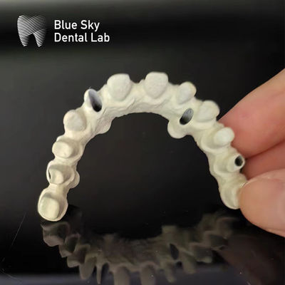 ซื้อ รางไทเทเนียม Malo Bridge สายพานปลูกฟันมาโล Custom online manufacture