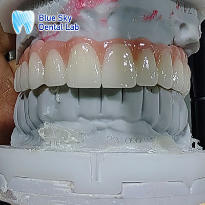ซื้อ กล่องปลูกฟันประดิษฐ์ กล่องปลูกฟันประดิษฐ์ online manufacture