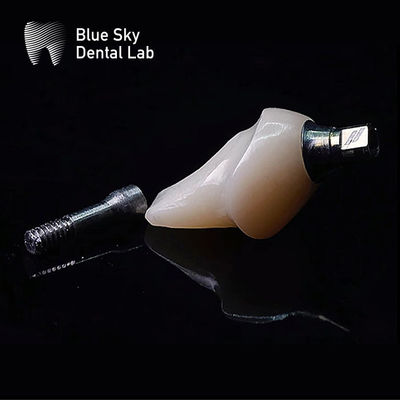 ซื้อ อุปกรณ์ปลูกทิตาเนียม Hypoallergenic With Zirconia Abutment ระบบปลูกทิตาเนียมฟ้าสีฟ้า online manufacture