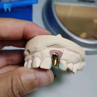 ซื้อ กล่องปลูกฝังปกติ ปลูกฝังฟันเดียวที่สามารถปรับแต่งได้ online manufacture