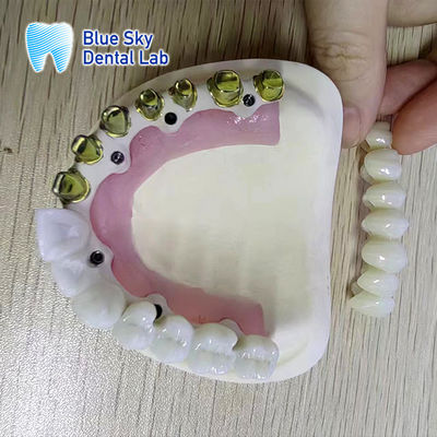 ซื้อ เอกลักษณ์การใช้เครื่องปลูกฟันแบบ Full Arch สําหรับระบบปลูกฟันแบบปกติหลายตัว online manufacture