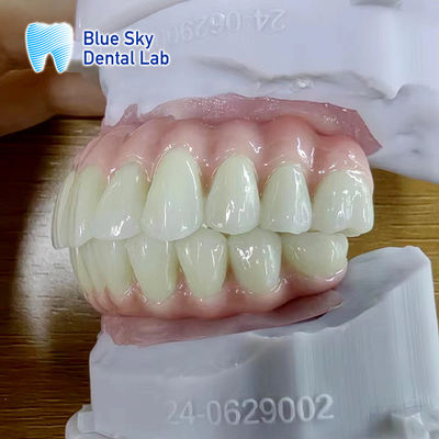 ซื้อ กรณีที่กําหนดเอง กรณีการปรับปรุงการปรับปรุงการปรับปรุงการใช้งาน online manufacture
