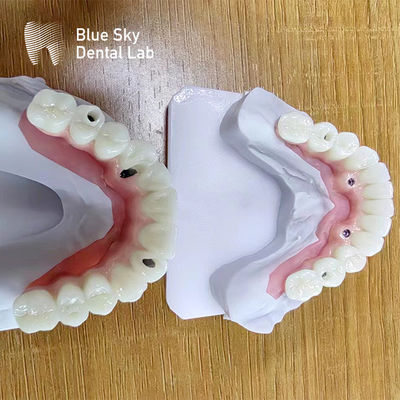 ซื้อ กล่องปลูกฝังฟันหลายกล่องกล่องประกอบการปลูกฝังที่กําหนดเอง online manufacture