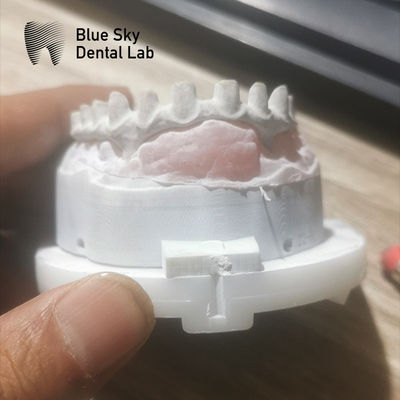 ซื้อ สะพาน Malo อุตสาหกรรมปรับแต่งในเงินและทอง สะพาน Malo Implant online manufacture