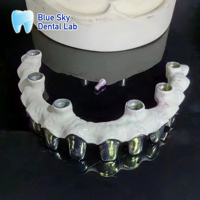 ซื้อ ทิตาเนียมบริสุทธิ์ Malo Bridge ปรับแต่งฟันกรอบโลหะเงิน online manufacture