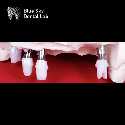 ซื้อ สีฟ้า การปลูกฟัน สีซิรคอนิยา online manufacture