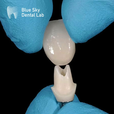 ซื้อ การสแกนทางปาก Custom Zirconia Abutment ความแข็งแรงสูง Zirconia Abutments online manufacture