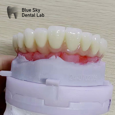 ซื้อ กรณีการดําเนินการการปลูกแบบธรรมชาติที่มีความสอดคล้องทั่วไปและผลงานที่ดีที่สุด online manufacture