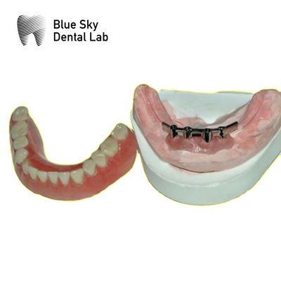 ซื้อ ไม้ทิตาเนียมฟันถอดได้ สําหรับฟันเทียม สีฟ้า online manufacture