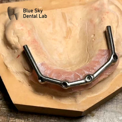 ซื้อ ฟันบนเต็ม ทิตาเนียม Bar ฟันเต็ม การฟื้นฟู Blue Sky Implant online manufacture