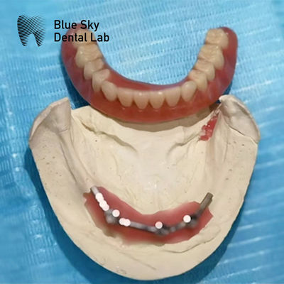 ซื้อ Blue Sky Implant Titanium Bar ฟันสําหรับฟันปลูก online manufacture