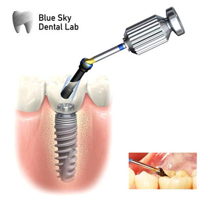 ซื้อ ภายใน Hex ASC Abutment ปรับเปลี่ยนมุมสกรูช่อง Abutment online manufacture