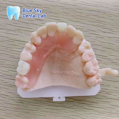ซื้อ ฟันเทียมส่วนหนึ่ง Valplast ที่สามารถถอดออกได้ สําหรับฟันข้างหน้าและด้านหลัง online manufacture