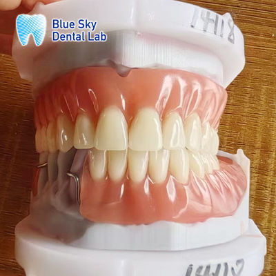 ซื้อ โรสซินอะคริลิค ปริมาณฟันส่วนถอดได้ด้วยสล็อป และปริมาณฟันอะคริลิคเต็ม online manufacture
