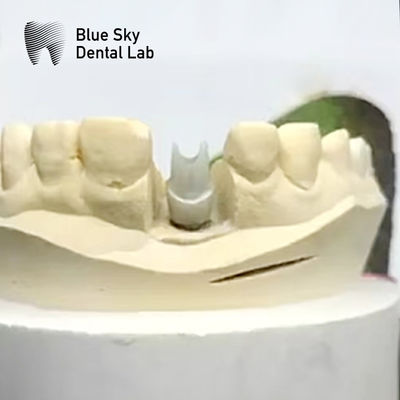 สวยงาม Zirconia Abutment Implant Biocompatible ความละเอียดบด