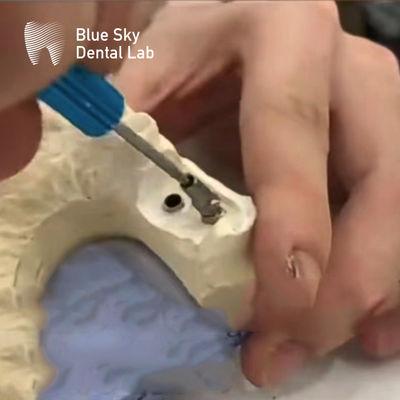 Anti Rotation ASC Abutment 0-35 องศา เงินมุมสกรูช่อง Abutment