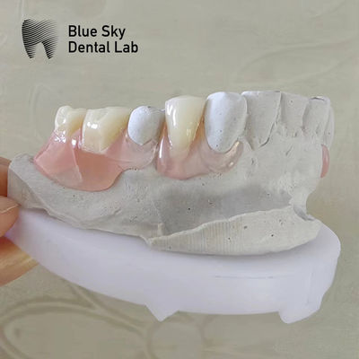 ยิ้มธรรมชาติ ฟันฟันฟันฟันฟันฟันฟันฟันฟัน