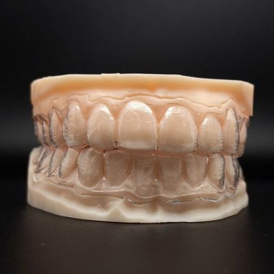 Customizable Teeth Invisible Aligners Clear Braces With Shorter Treatment Time